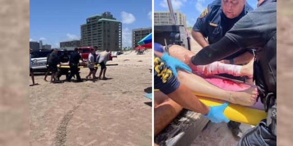 Nikki Soto "Shark Attacks at South Padre Island Fourth of July