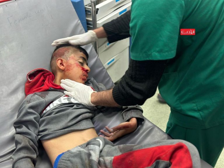 Israeli Army Bombs Civilian Tent in Gaza, Critically Wounds Child