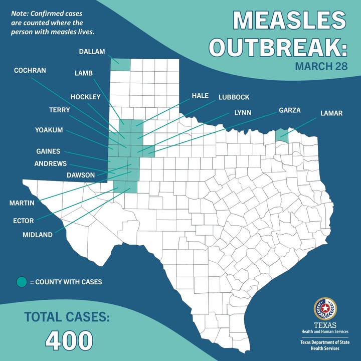Massive Measles Outbreak: 400 Cases Ignites Public Health Crisis!