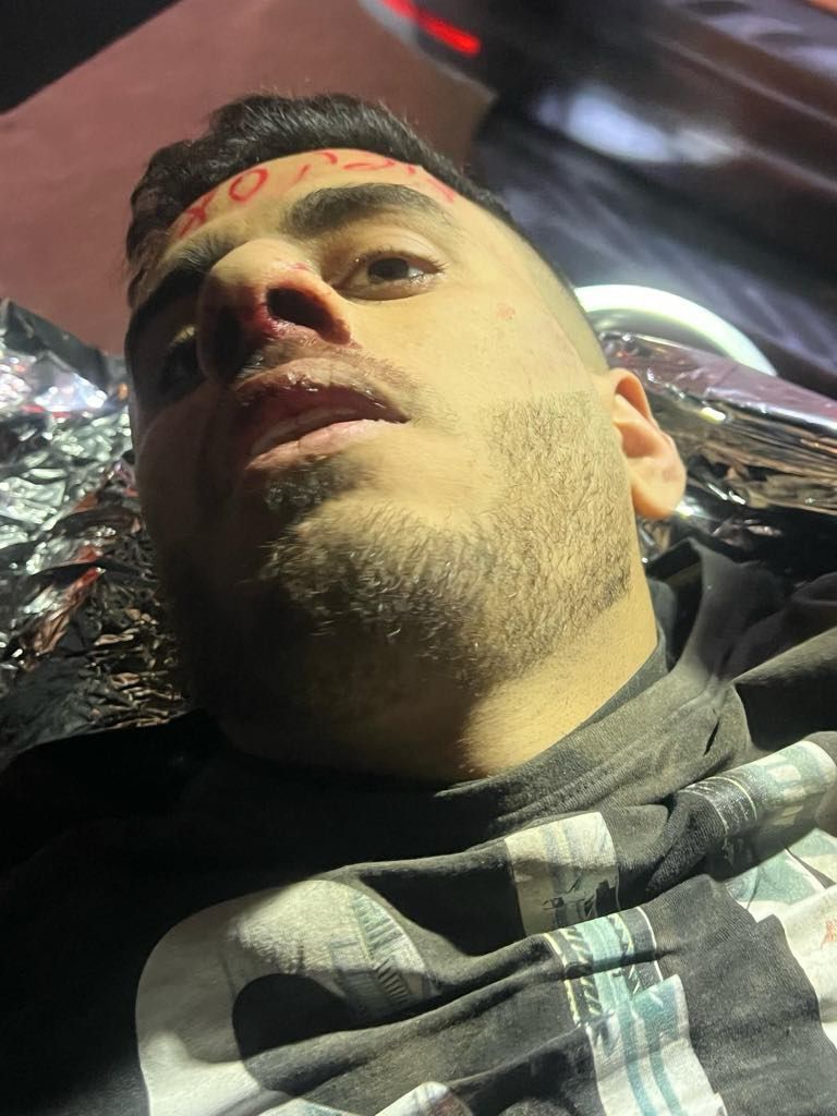 Outrage as Israeli Forces Arrest, Shoot Palestinian Near Settlement