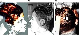 🚨 Shocking JFK Autopsy Photos Leaked! Only 10 Minutes Left! ⚠️