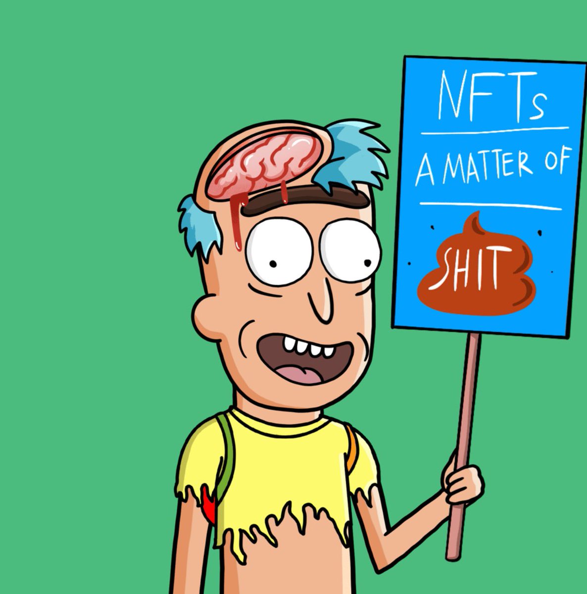 Shocking NFT Win: Is This the Future or Just a Fad? 🤔🔥
