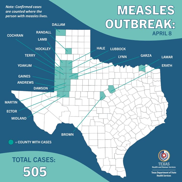 505 Measles Cases in South Plains: 2 School Kids Dead!