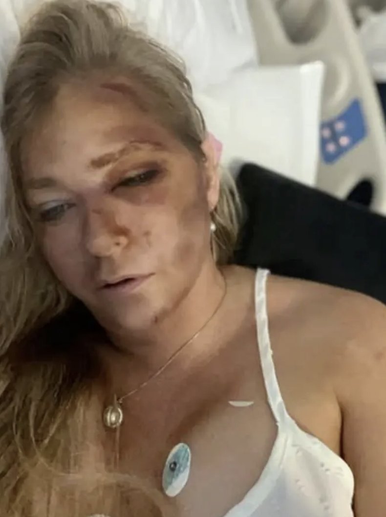 🚨UPDATE🚨 Giuffre Charged with Restraining Order Violation!
Claims Critical Injury Days Before Facing Legal Troubles