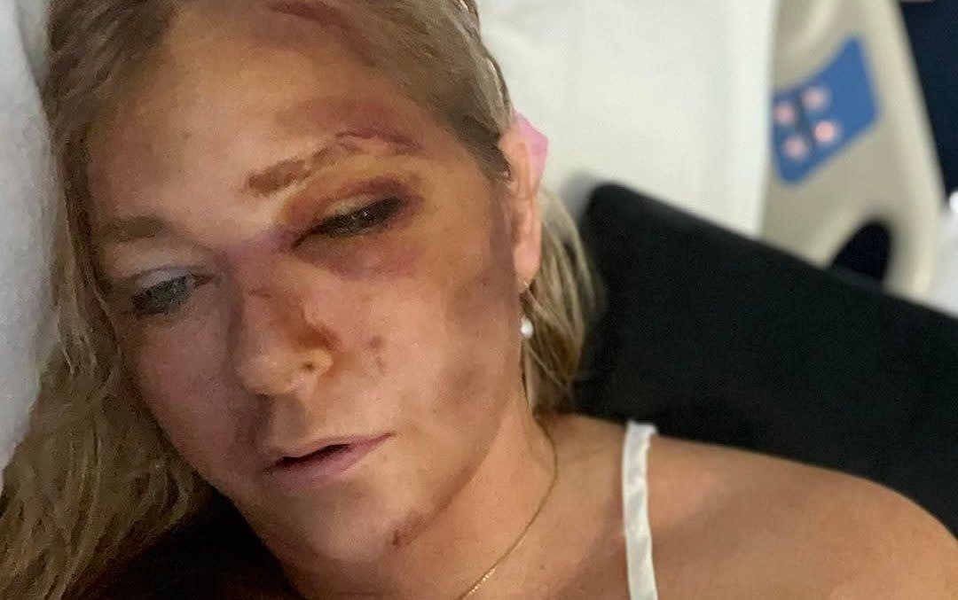 Virginia Giuffre's Shocking Claim: "4 Days to Live" After Crash!