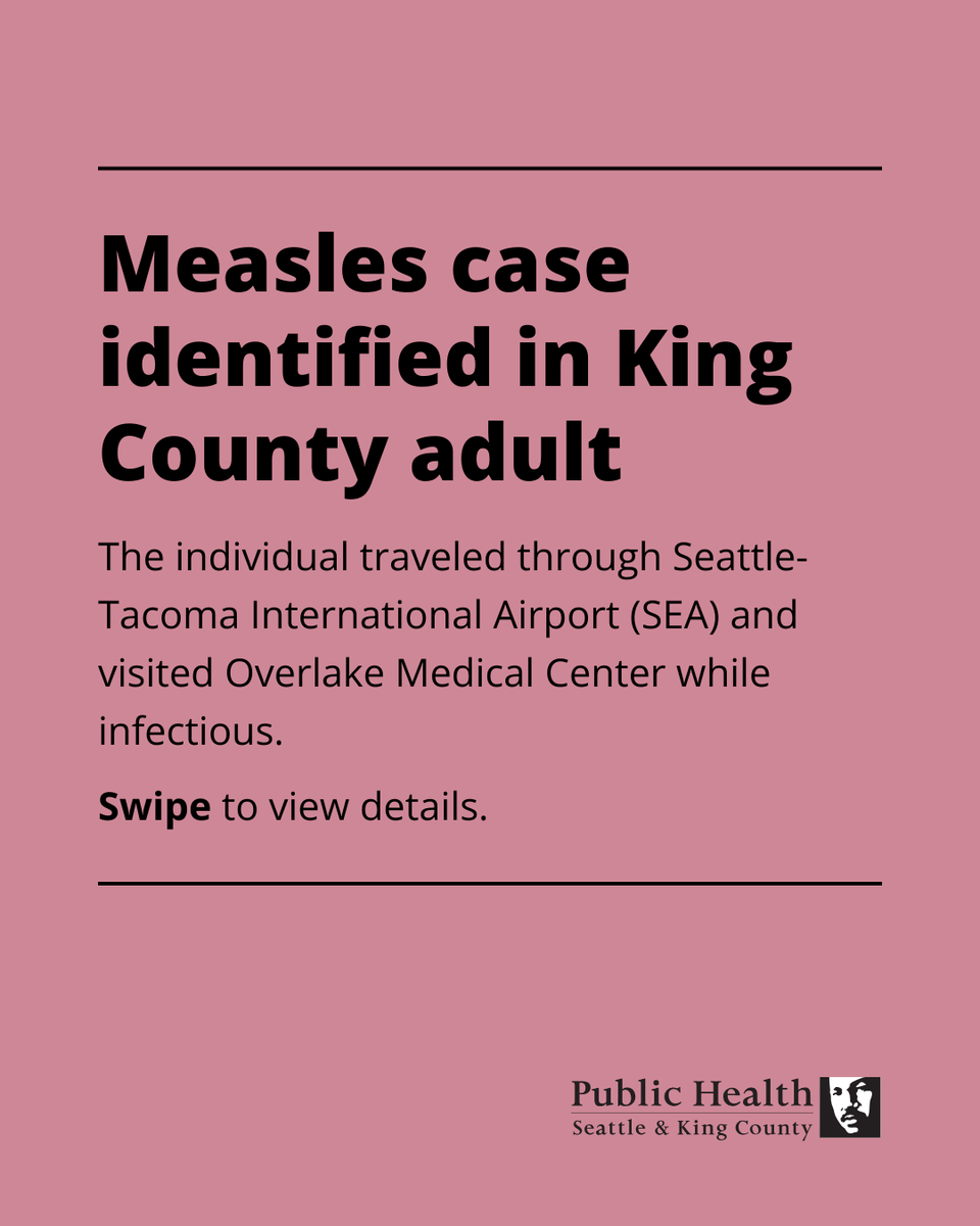 Measles Resurfaces: King County Adult Infectious at Airport!