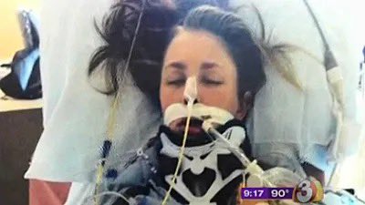 Miraculous Survival: Woman's Spine Separated, Defies Death!
