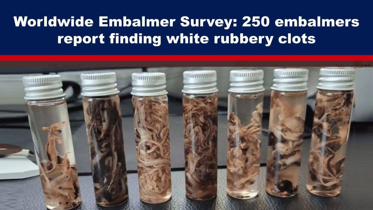 Shocking Survey: 83% of Embalmers Discover Mysterious White Clots!