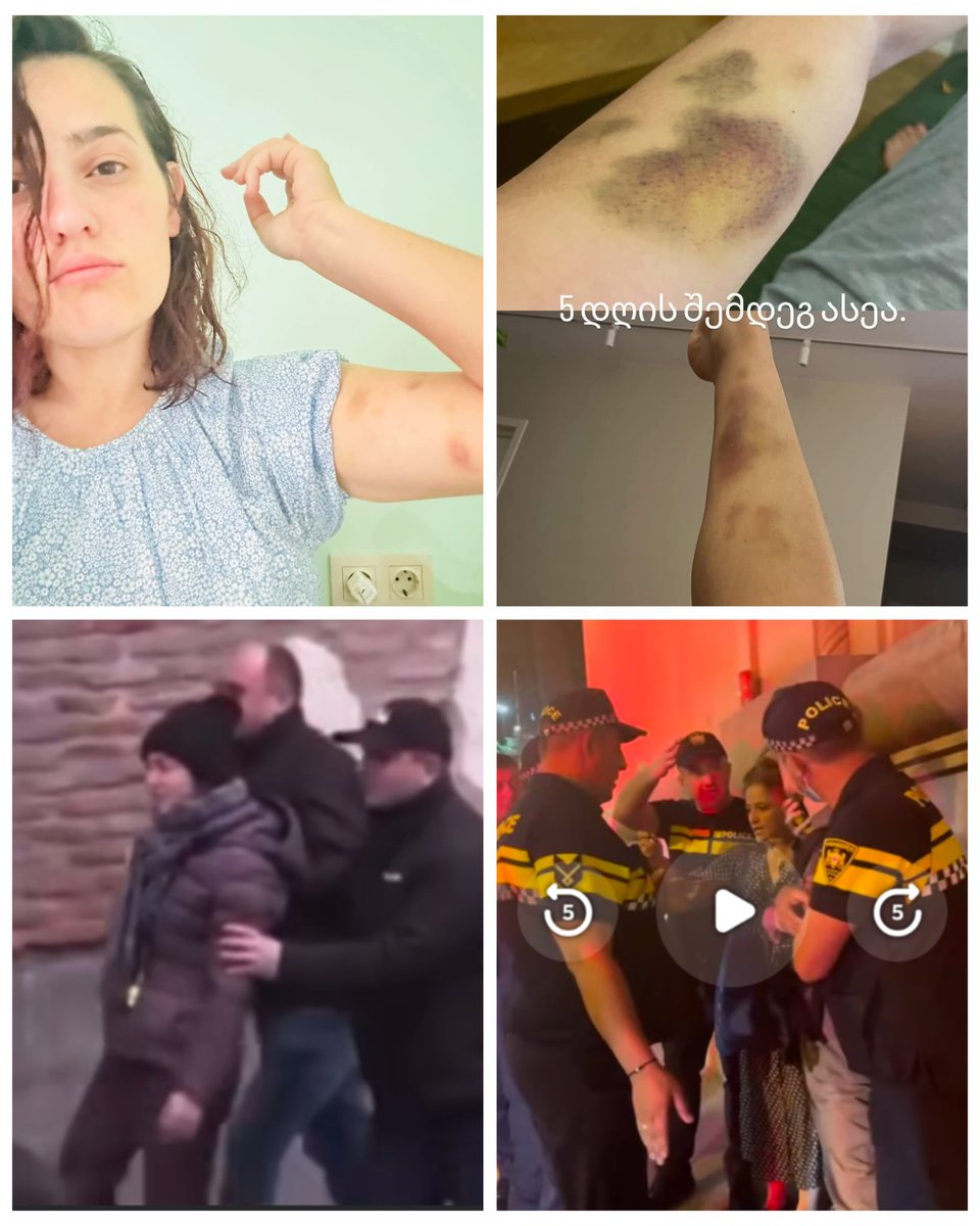 Women Expose Police Brutality on 'Police Day' with Shocking Footage!