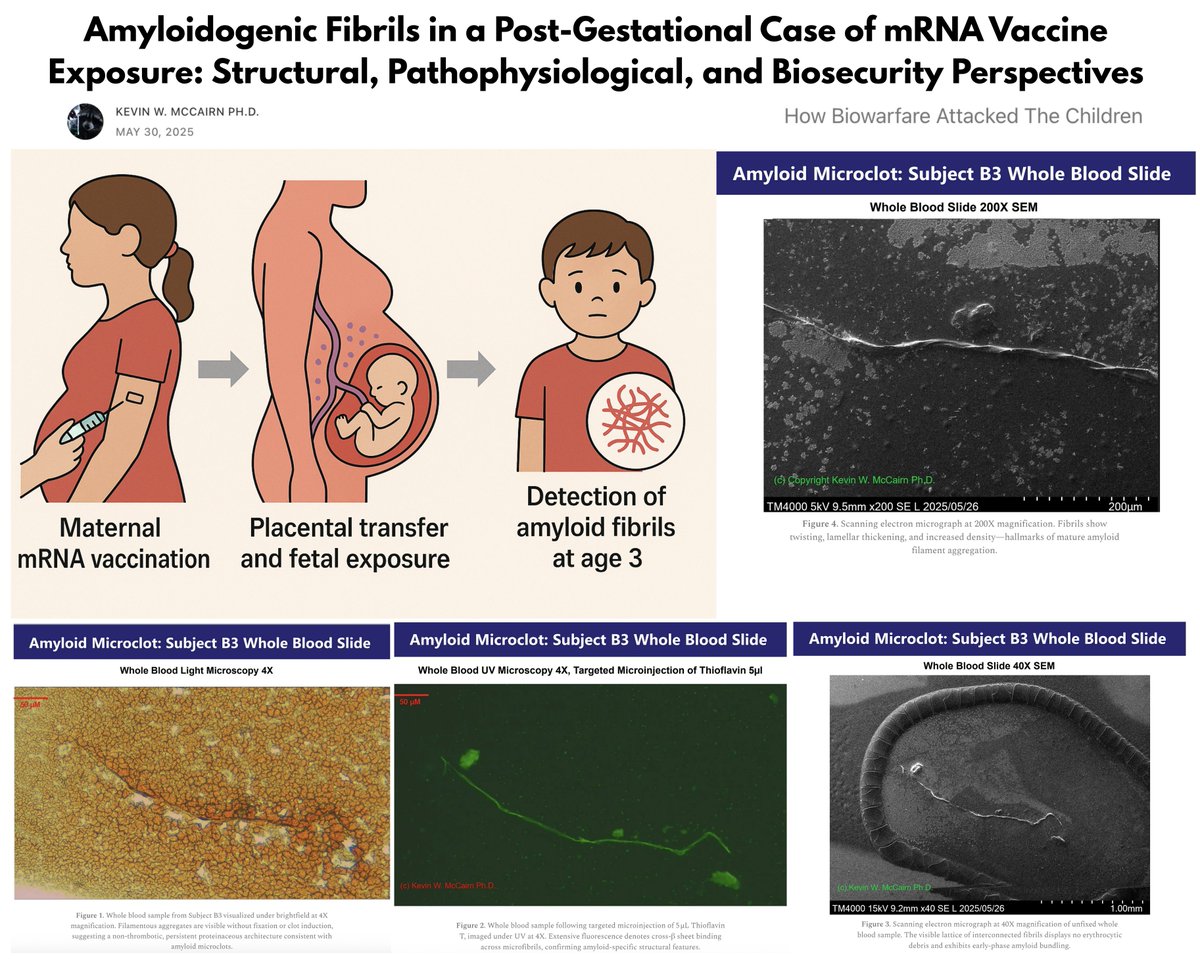 🚨 BREAKING: Shocking Link Between mRNA Shots and Child's Illness!