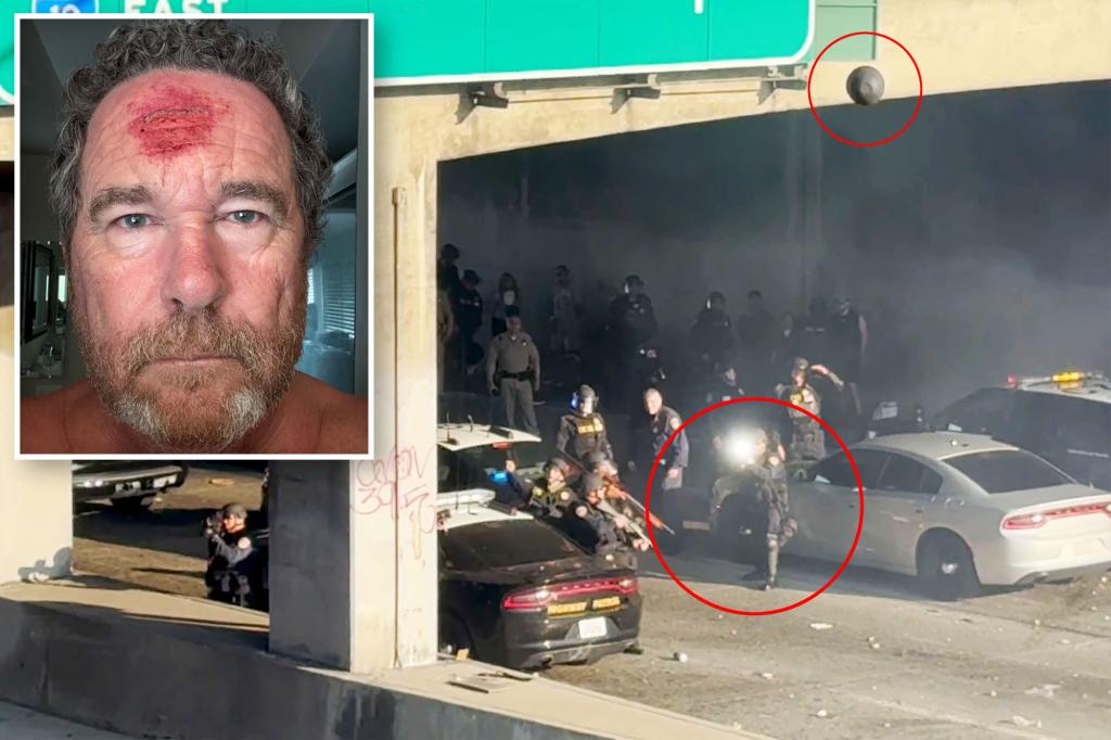 LA Anti-ICE Riots: Photographer Shot in Head with Rubber Bullet!