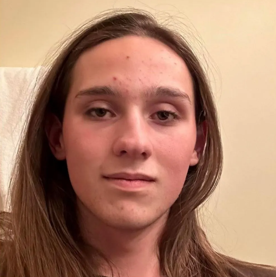 Missouri Tesla Firebombing Suspect Gets Gender Care, Faces 30 Years!