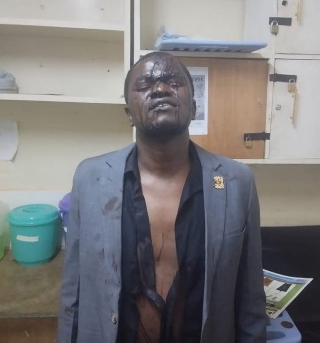 Outrage Erupts: Tortured Man's Death Demands Police Murder Charges!