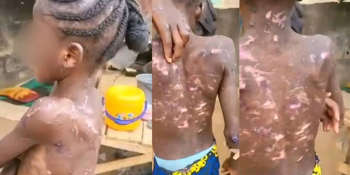 Shocking Abuse: Police Arrest Woman for Starving 14-Year-Old!