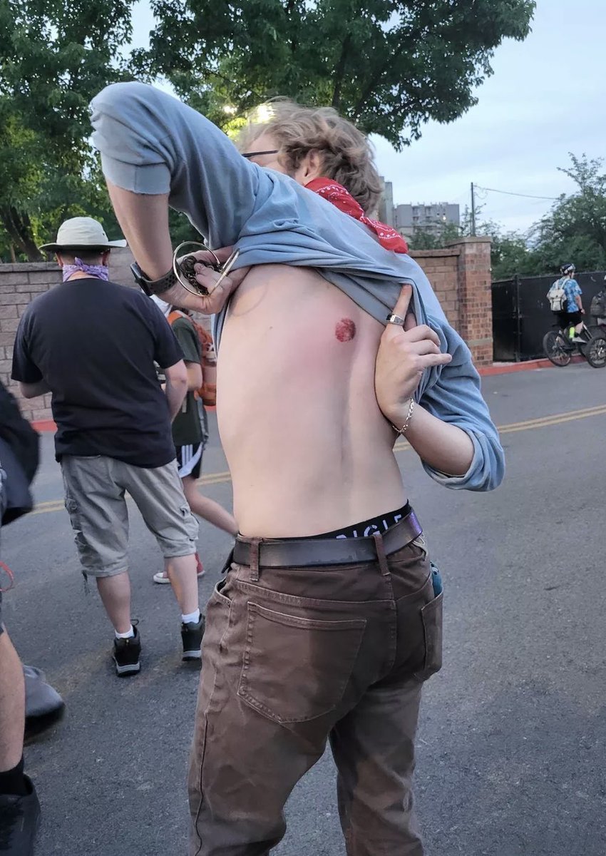 Spokane Police Chief Denies Rubber Bullets Amid Protestor Threats!