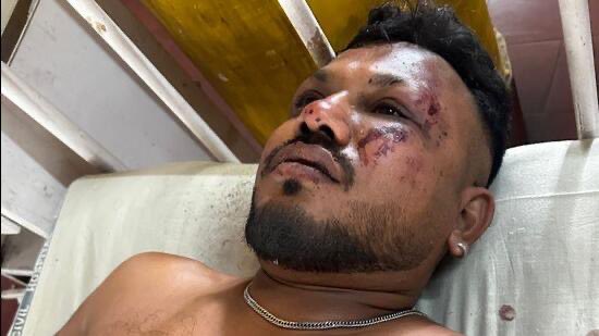 Survivor of Air India Crash: Brother Missing, Chaos Unleashed!
