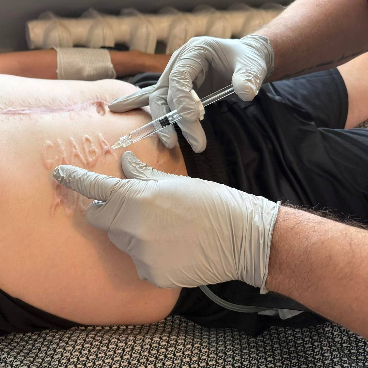 Ukrainian Soldier's Abdominal Inscription: Shocking Betrayal by Surgeon
