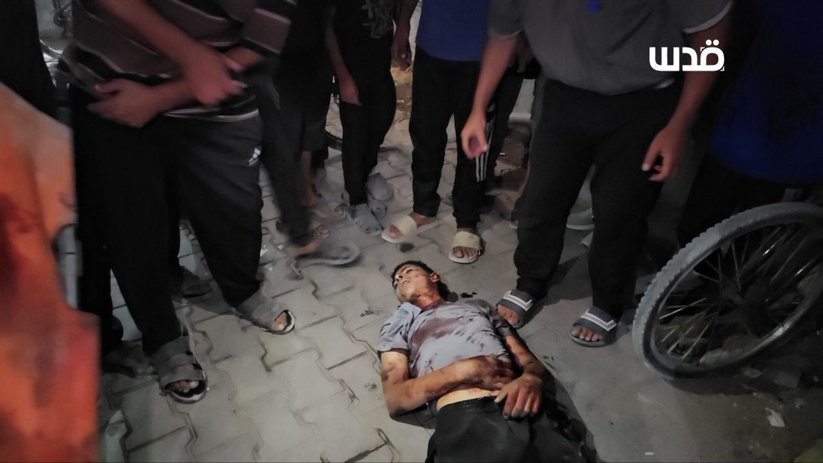 88 Killed in Gaza: Airstrikes Spark Outrage Worldwide! —  Gaza airstrikes news, Palestinian casualties update, Israel conflict 2025