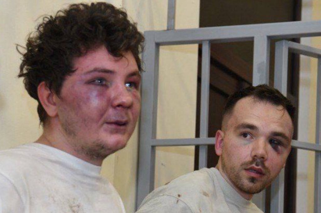 Azerbaijan's Shocking Photos of Bruised Russians Spark Outrage!