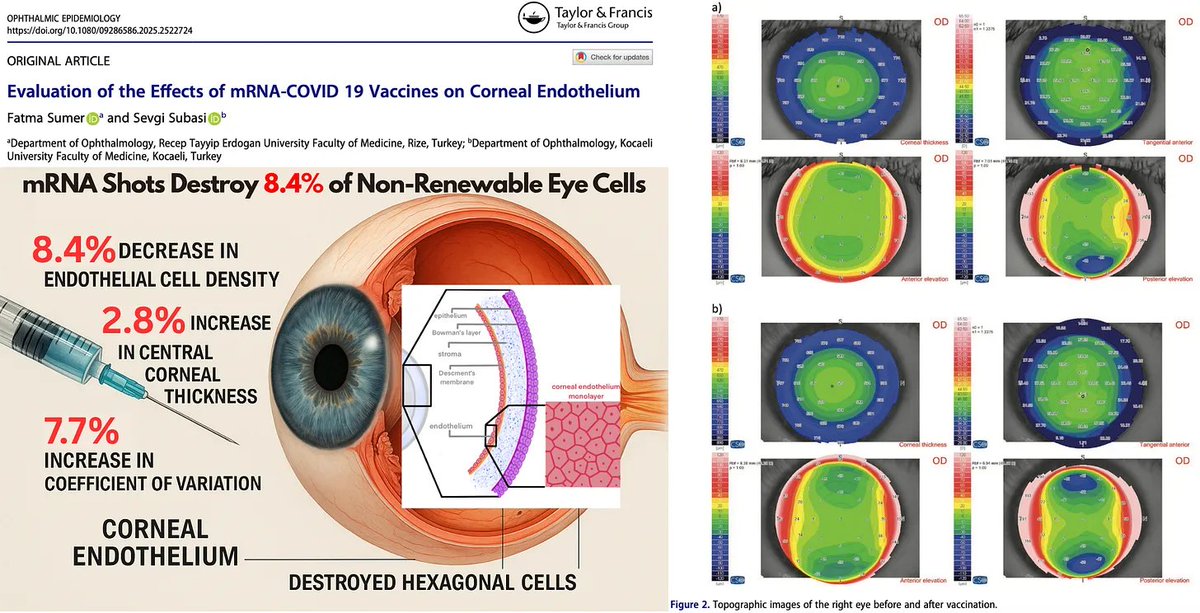 Shocking Study: mRNA Vaccines Linked to Eye Damage! —  mRNA vaccine eye damage, irreversible vision loss young adults, corneal health concerns 2025