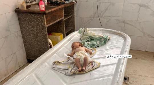 Tragic Death of Gaza Infant Sparks Global Outrage! —  Palestine humanitarian crisis, Gaza malnutrition epidemic, Israel blockade impact 2025