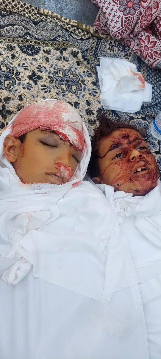 🚨 Tragic Loss: Israeli Airstrike Kills Young Siblings in Gaza Tent - Who is to Blame? 🇵🇸🇮🇱 —  Israeli airstrike casualties, Gaza family tragedy, Children victims of conflict
