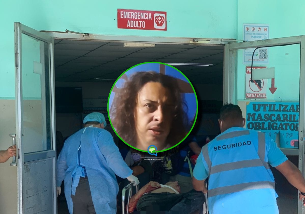Muere Brayan Díaz tras disparo en subestación policial de Atlántida