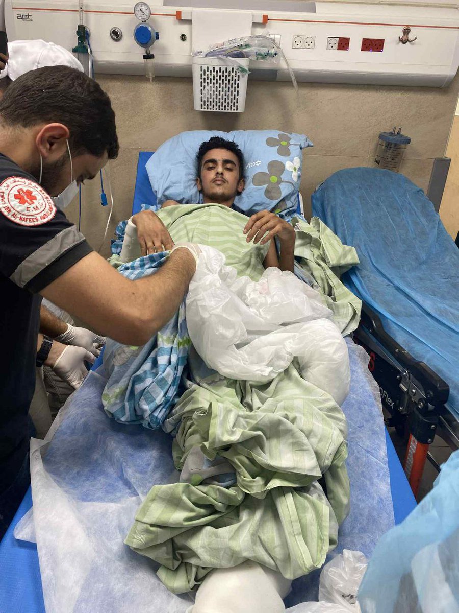 Shocking Release: Amputated Man Sparks Outrage! —  Israeli military actions 2025, Palestinian health crisis, amputee rehabilitation in Palestine