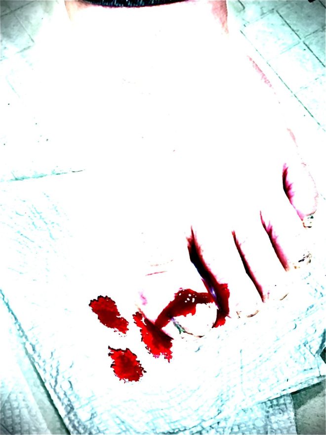 Death Strikes: I Almost Died Moving a Table, RIP Big Toe