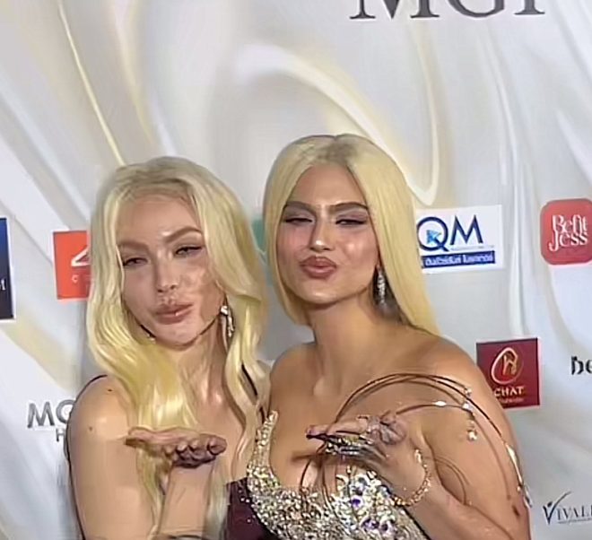 Charlotte and Rachel: Double Trouble Shaking Up Hearts Tonight!  
I'm Weak! The Controversy of Their Stunning Appearance!