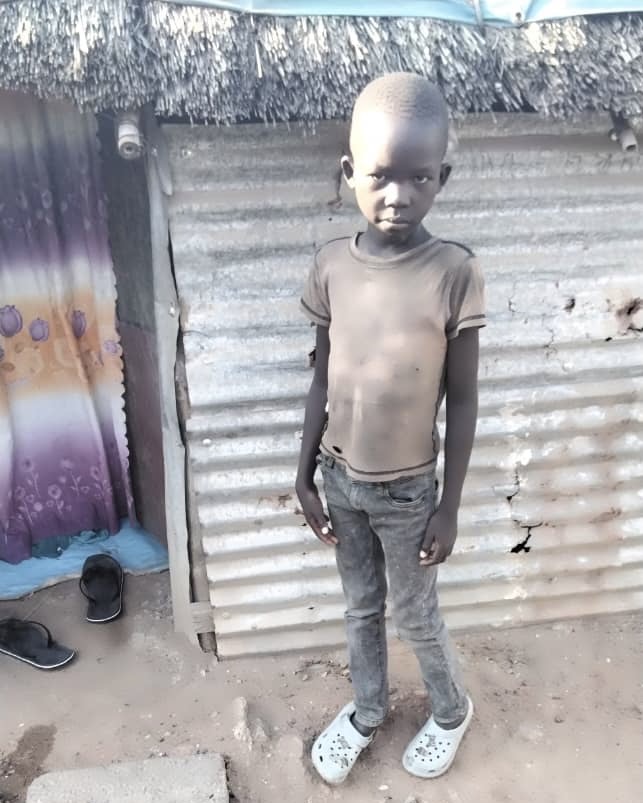 Death of Five-Year-Old Evan Anzoo Highlights Aid Shutdown Tragedy