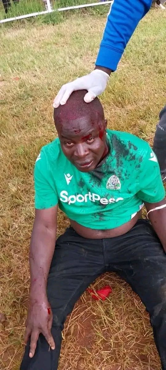 Death Shocks Fans as Gor Mahia Supporter Dies in Brawl