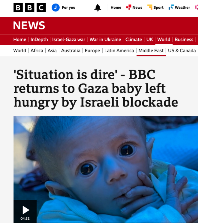 Is This Baby "Hungry" or a Victim of Deliberate Starvation? — "humanitarian crisis Gaza", "Palestinian children's health 2025", "Israel conflict starvation issues"