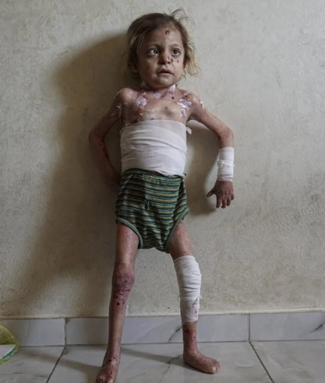 "Photo of Little Angel Girl Sparks Controversy - 🇵🇸 Pray for Her 💔" — Innocent child, Heartbreaking image, Support and prayers