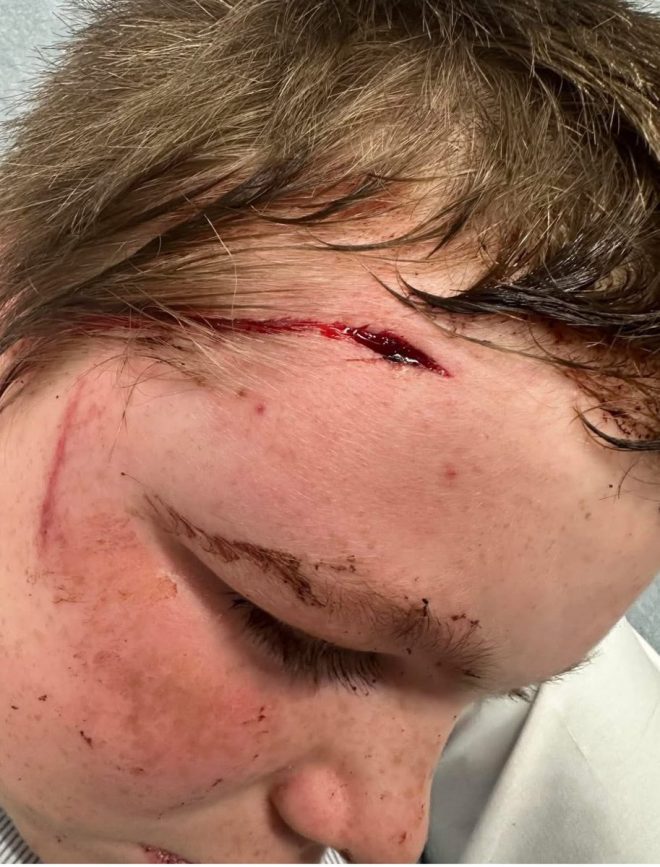 Shocking Incident in Madison: Kids Harass Dog, Boy Steps In!