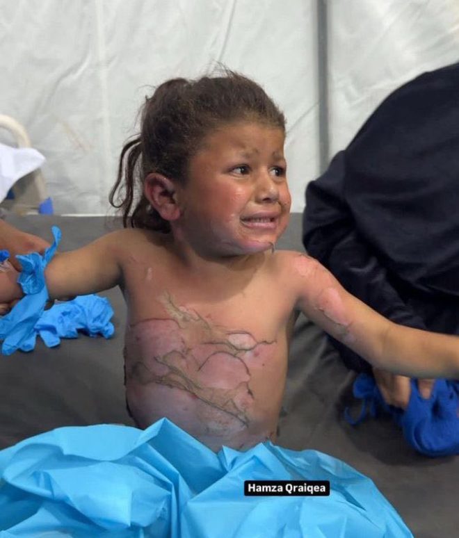 "Shocking Photo of Little Angel Sparks Controversy - π΅πΈ Pray for Her π" β Pray for children, Heartbreaking image, Spread awareness