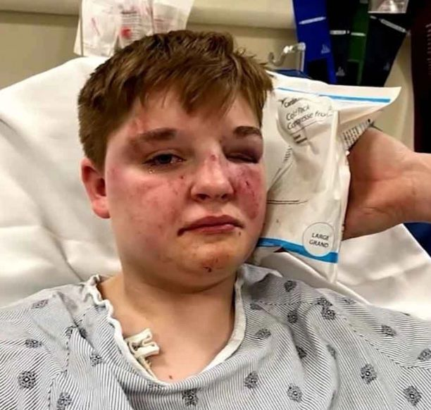 Teen Lesbian Attacked in McDonald's Restroom: Shocking Hate Crime! — Kady Grass McDonald's incident, LGBTQ+ violence Carpentersville, restroom discrimination 2025