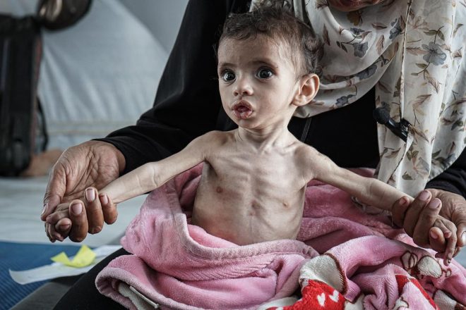 4kg Baby Born in War Zone: A Heartbreaking Crisis Unfolds — child malnutrition crisis Gaza, humanitarian emergency Khanyounis, Gaza blockade impact on health