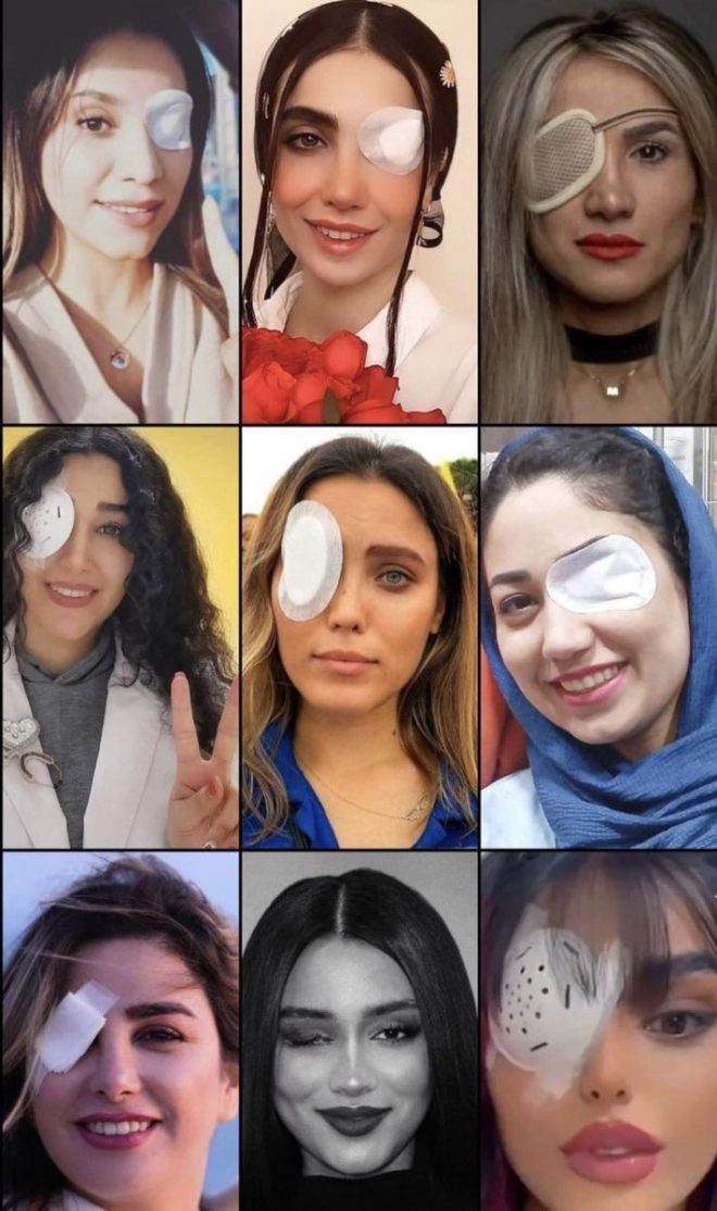 Blinded for Rights: Are Protests Justified? — Iranian women's rights activism, Islamic regime human rights abuses