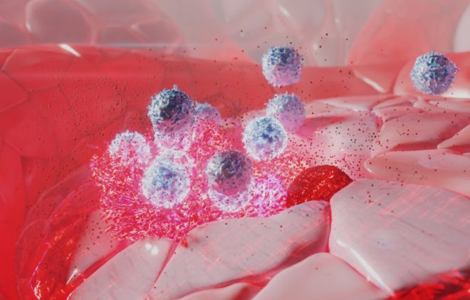 "Controversial Breakthrough: Natural Killer Cell Therapy Doubles AML Patients' Survival - Cancer Immunotherapy Revolutionizes Treatment!" — natural killer cell treatment, leukemia breakthroughs, immune system cancer therapy