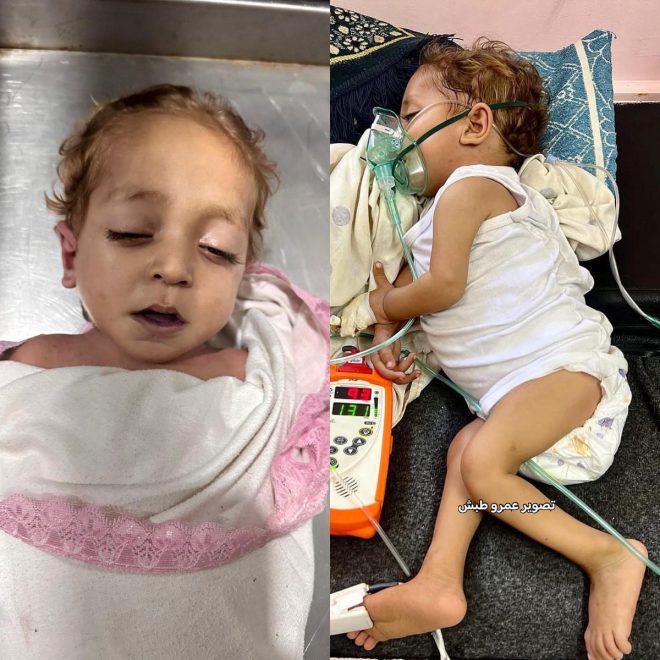 Death of Little Hassan Barbakh Highlights Gaza's Healthcare Crisis