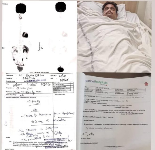 Desperate Fight: 29-Year-Old Faces Cancer with Colostomy! — cancer treatment support, fundraising for medical bills, support cancer patients