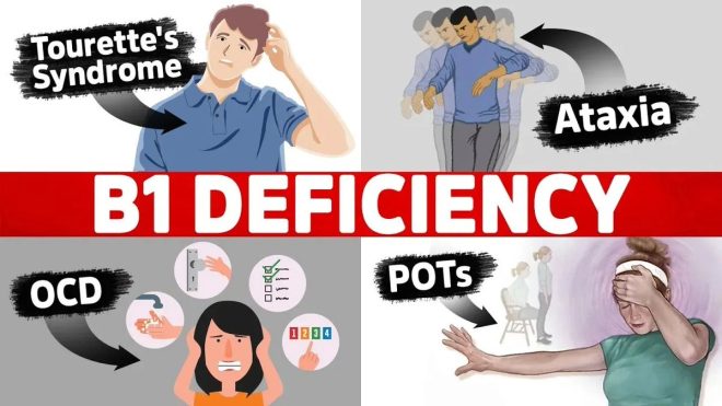 Is Your Anxiety Fueling a Vitamin B1 Crisis? — Vitamin B1 and Mental Health, Natural Remedies for Anxiety Relief, Nerve Support Supplements 2025