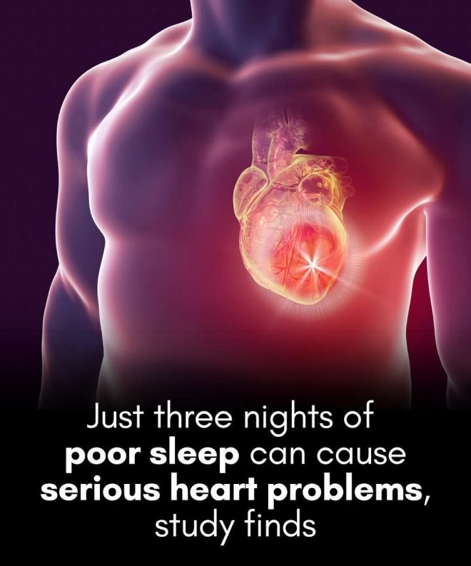 Just 3 Sleepless Nights Can Break Your Heart! —  insufficient sleep heart health, sleep deprivation cardiovascular issues, short sleep duration heart risks