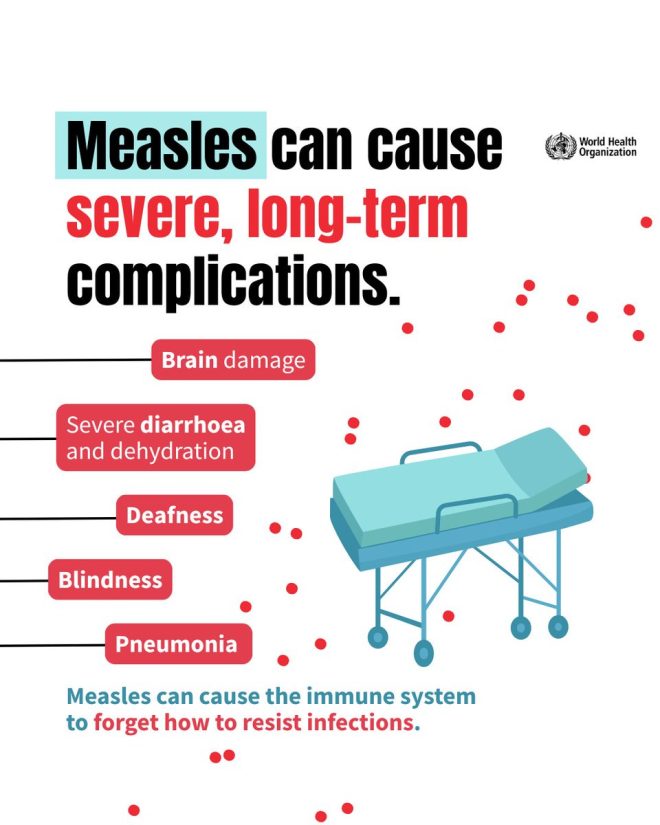 Measles: The Hidden Dangers You Didn't Know! — Measles vaccination importance, Long-term health effects of measles, Preventing measles complications