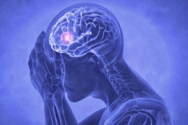 Mini-Stroke Myths: The Hidden Truth Revealed! — mini-stroke recovery challenges, post-stroke fatigue symptoms, brain inflammation effects
