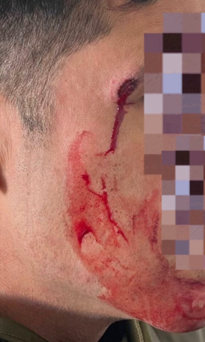 Shocking Attack: ICE Officer Blindsided by Antifa Protester! — DHS officer safety, Antifa protests Portland, increase in assaults on law enforcement 2025