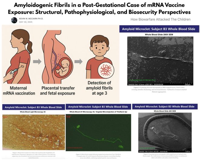 Shocking Discovery: 3-Year-Old with Amyloid Fibrils! — mRNA vaccine safety studies, pediatric health complications, in-utero vaccine effects