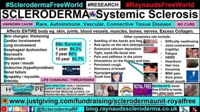 Shocking Scleroderma Symptoms: Are You Aware? — Scleroderma Symptoms Guide, Systemic Sclerosis Awareness Campaign, Chronic Pain Management Strategies