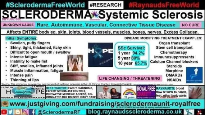 Shocking Scleroderma Symptoms Revealed! — Scleroderma symptoms infographic, autoimmune disease awareness June, systemic sclerosis puffy fingers 2025